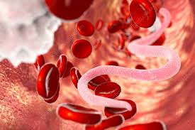 Blood for Microfilaria