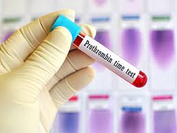 Clotting Time Test